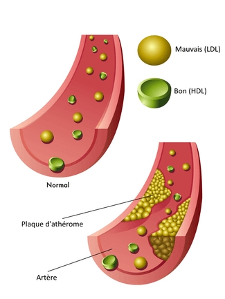 coenzyme Q10